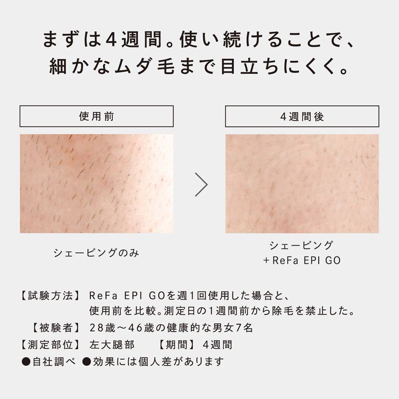 ReFa「リファエピゴー」|コスメ雑貨|