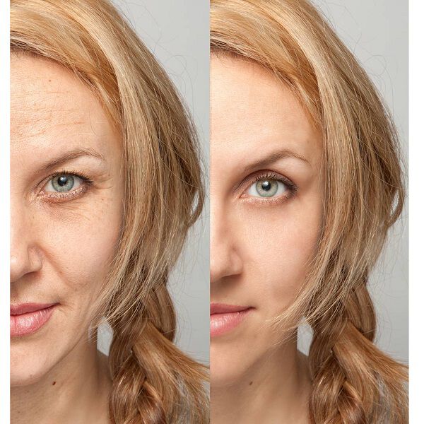  「ドーマティン (Dermartin-TS) D-TS リペアライン 90セコンド (10ml)」|アイケア|