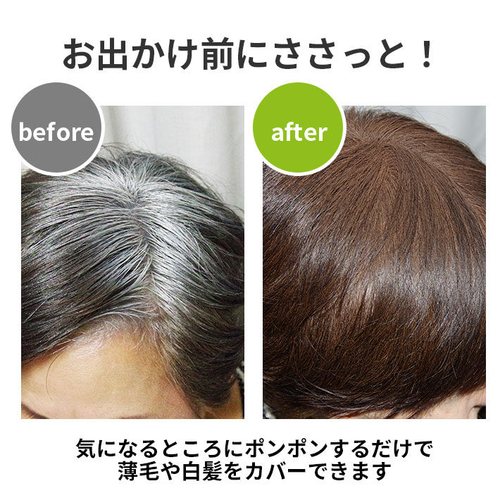BACKYARD FAMILY「白髪染め 通販 ポンポン頭皮ファンデ 薄毛隠し 白髪隠し 頭皮ファンデ 頭皮ファンデーション」|ヘアスタイリング|