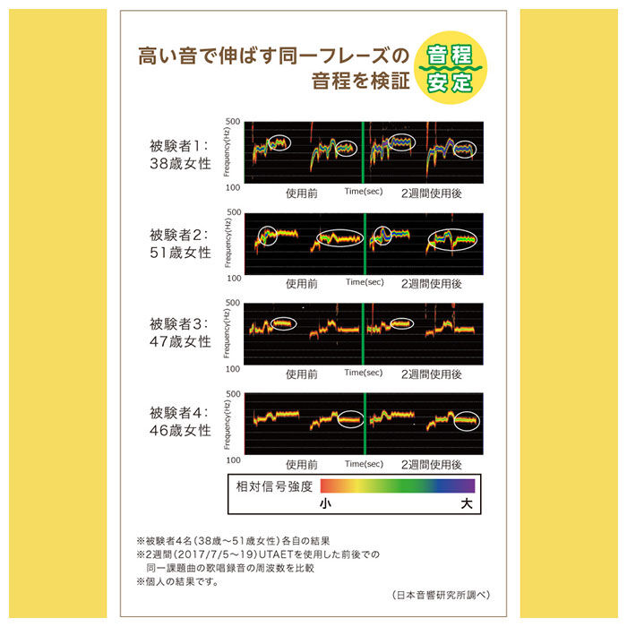 BACKYARD FAMILY「ボイストレーニンググッズ 通販 ウタエット UTAET ボイトレグッズ 消音機能 リアルボイス機能」|その他|