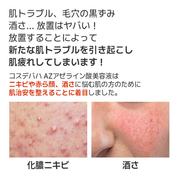  「Cos De BAHA AZアゼライン酸10美容液 (30ml)」|美容液・オイル・クリーム|