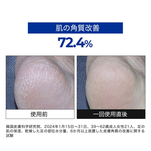  「MEDIPEEL EGF スケーリングモイスチャーフットクリーム (130g)」|フットケア|