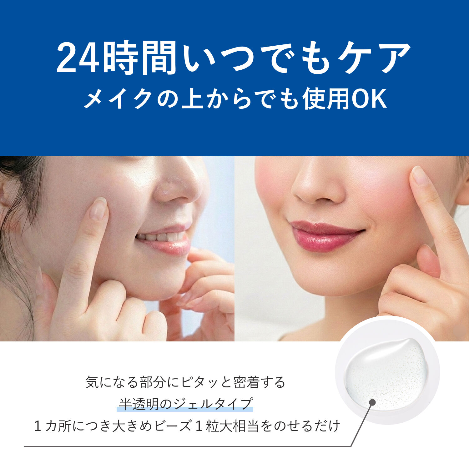 クリアフル「ORBIS クリアフル アクネ スポッツ 20g」|美容液・オイル・クリーム|
