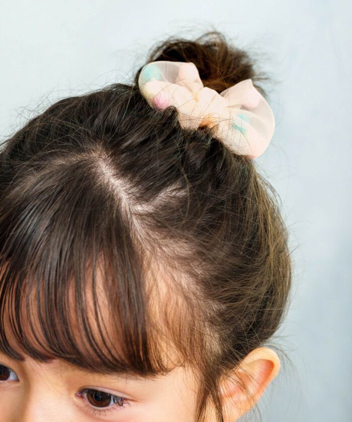 BACKYARD FAMILY「Rora ヘアゴム キッズ 通販 ローラ ドロシー 髪ゴム 髪飾り 髪どめ 髪留め」|ヘアゴム・シュシュ|